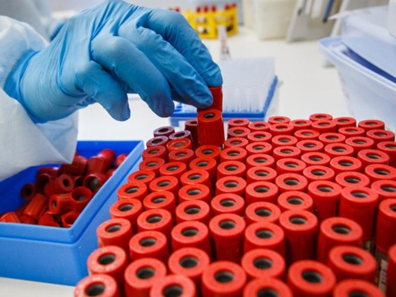 Эпидситуация заболеваемости ВИЧ-инфекцией