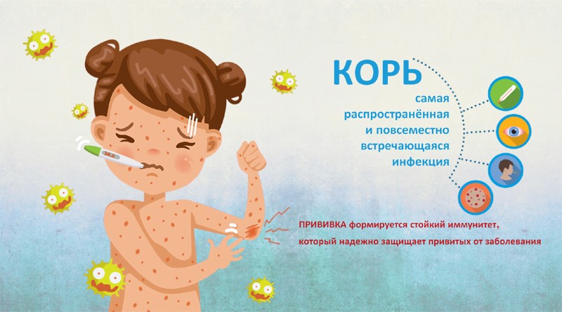 Корь и ее профилактика