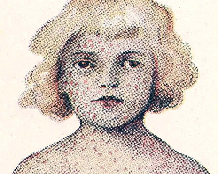 ВНИМАНИЕ!  КОРЬ.