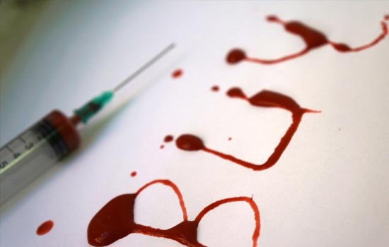 Эпидситуация заболеваемости ВИЧ-инфекцией