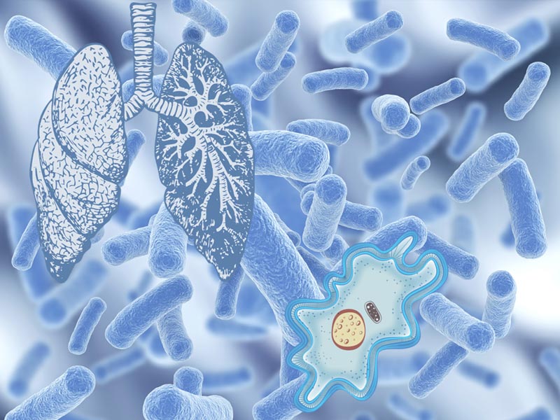 Что нужно знать о легионеллезе