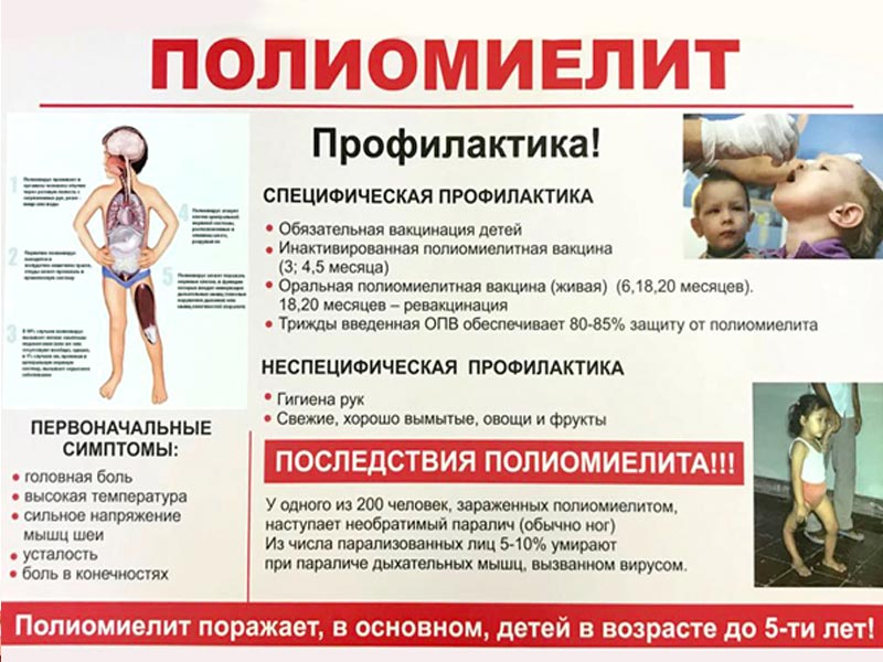 Полиомиелит и его профилактика