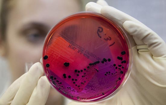 Об очагах сибирской язвы