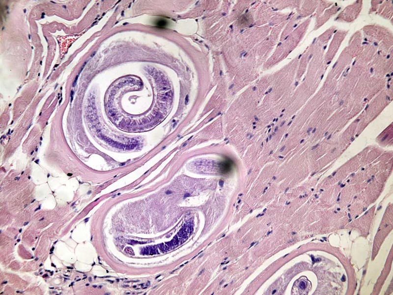 Внимание Трихинеллез