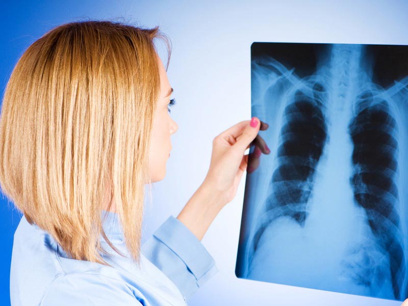 Всемирный день борьбы с ТУБЕРКУЛЕЗОМ