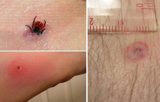 Первые случаи нападения клещей!